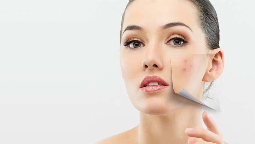 Μικροδερμοαπόξεση με διαμάντι