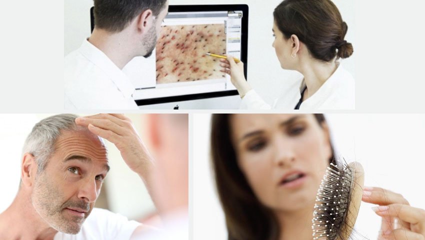 Παθήσεις τριχών και ονύχων