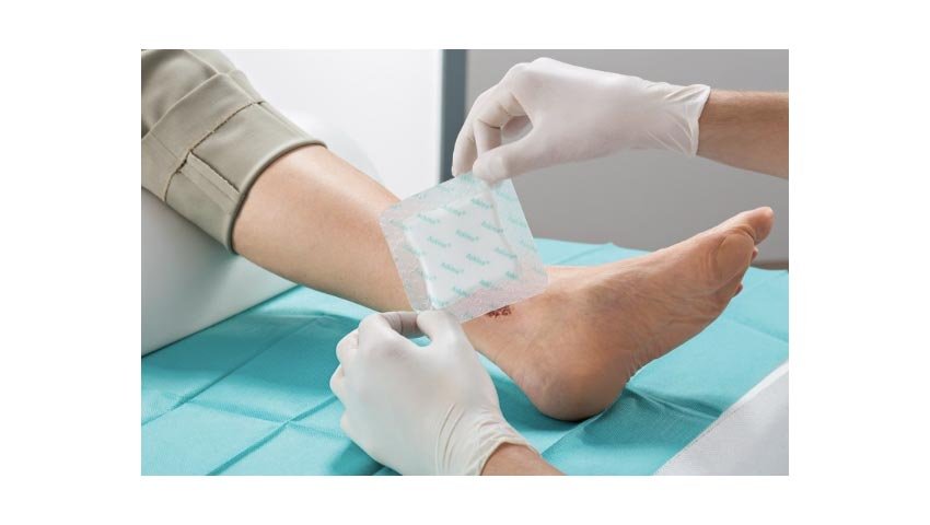 Τμήμα χρόνιων ελκών