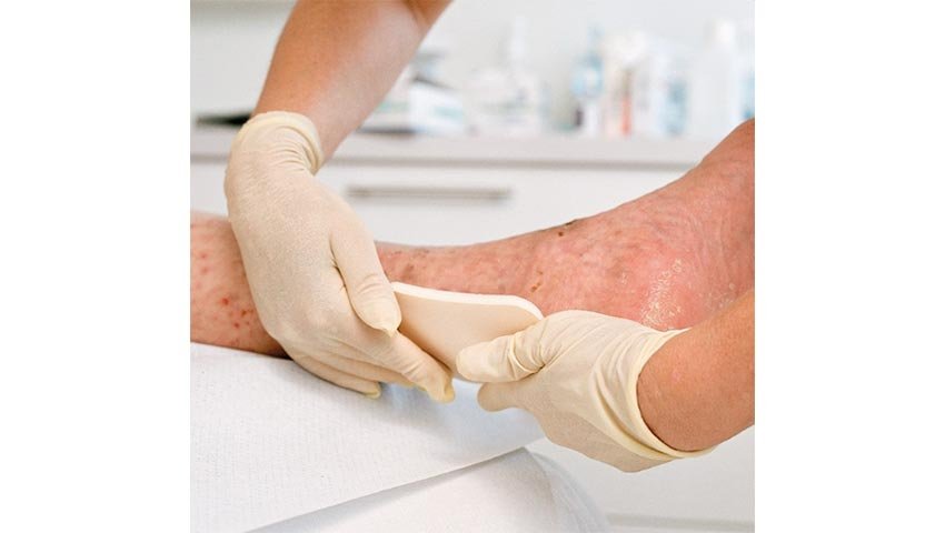 Τμήμα χρόνιων ελκών